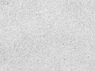 淬火硬化層金相組織照片